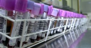 Leia mais sobre o artigo Cientistas chineses anunciam criação de embriões humanos imunes ao HIV